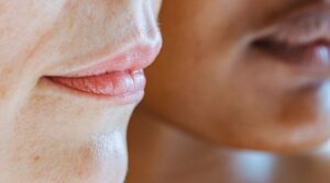 The Internal Blueprint: A Scientific Melasma Cure Using Lab-Test Insights