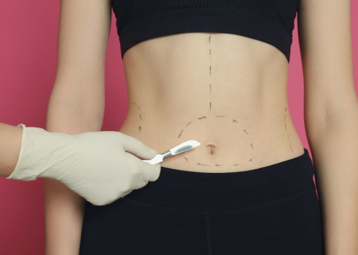 Surgical-Grade Body Mapping